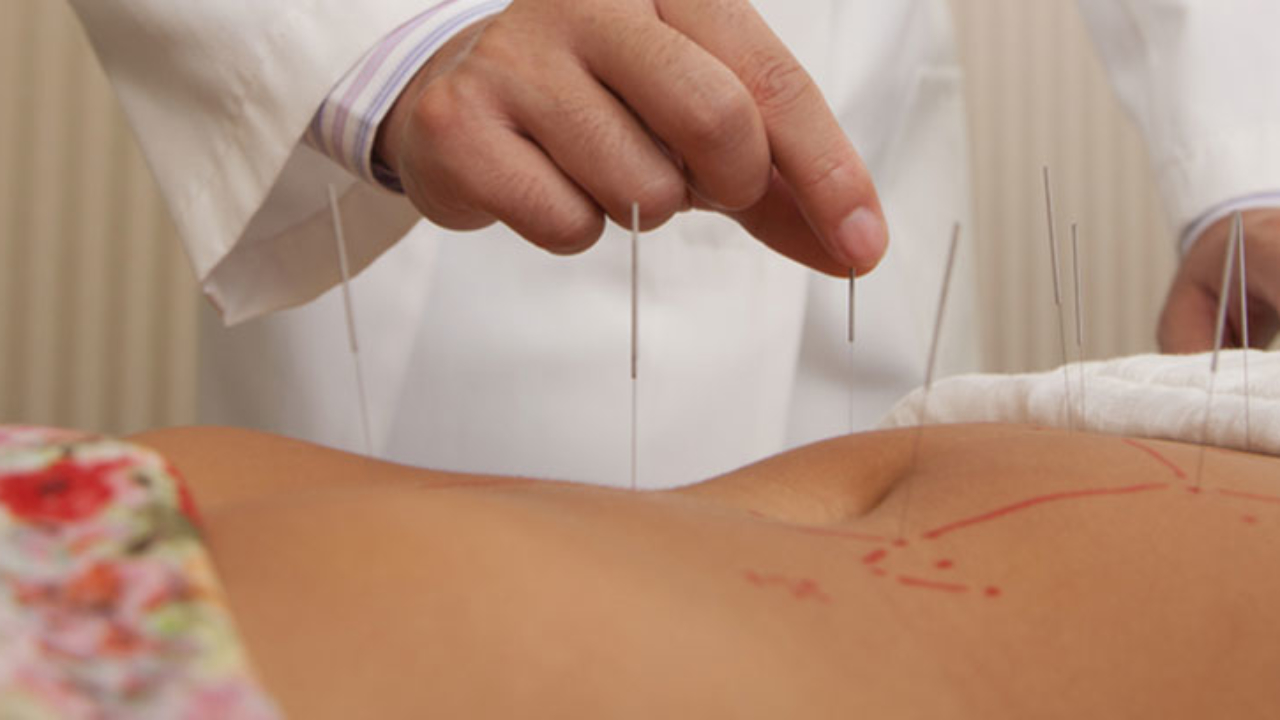 Acupuntura en ginecología y obstetricia - canalSALUD