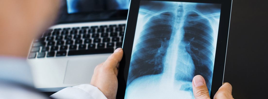 Un médico observa una radiografía del pecho en una tablet