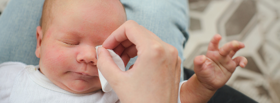 conjuntivitis-recien-nacidos-3