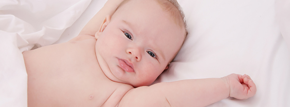 Qué es la costra láctea del bebé?