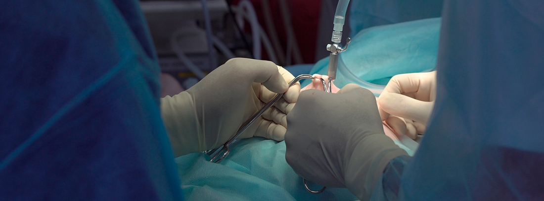 cuidados de una laparoscopia de vesicula