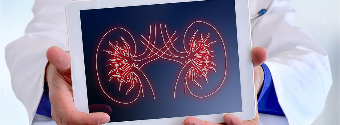 Un médico sostiene una tablet con la imagen de unos riñones