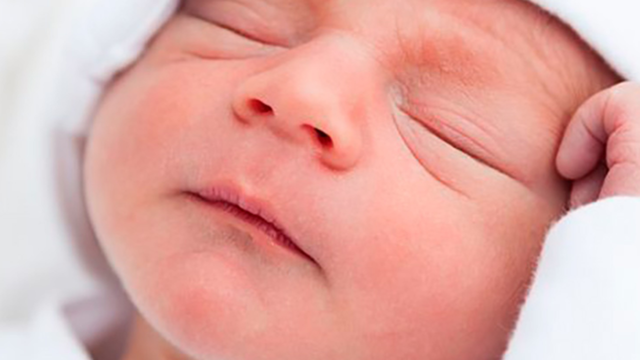 Enfermedades Bebe Piel De Arlequin Canalsalud Enfermedades Bebe Piel De Arlequin Canalsalud