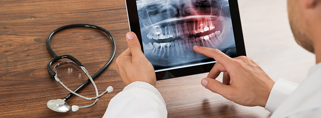 Dentista viendo en una tablet la radiografía de una dentadura