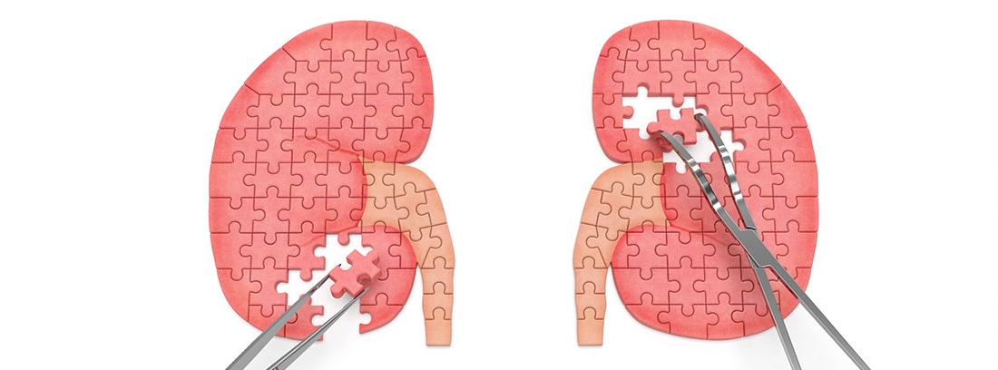 filtrado glomerular alto sintomas filtrado glomerular alto sintomas
