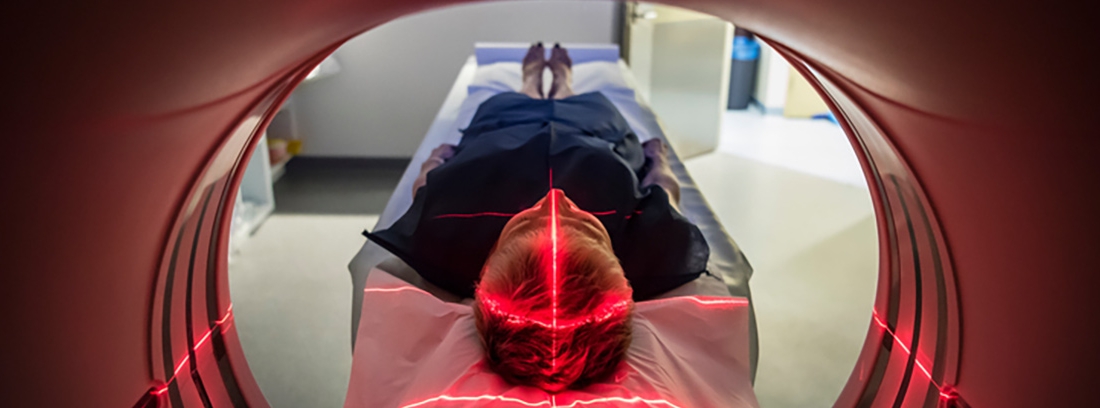 ¿Es el edema un síntoma de hipertensión?