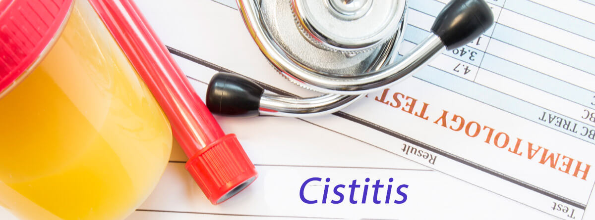 Cistitis