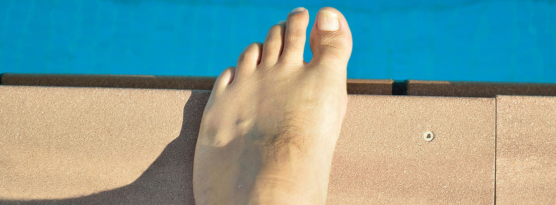 Pies en la piscina. Infecciones más comunes y consejos para