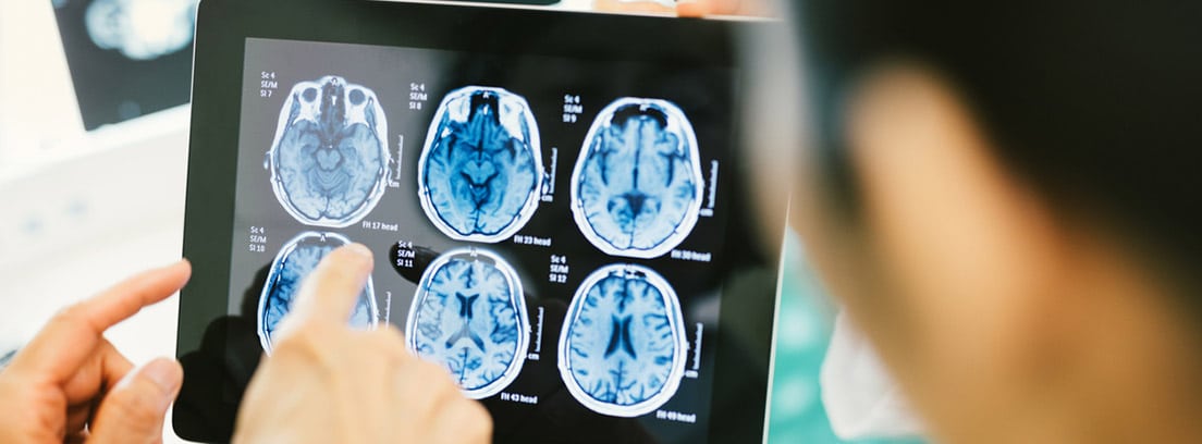 Megaloblastoma, tumor cerebral en niños: resultados de resonancia magnética del cerebro