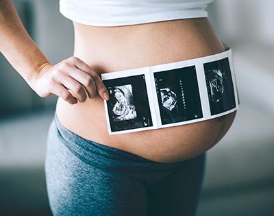 mujer embarazada con una ecografía sobre el vientre