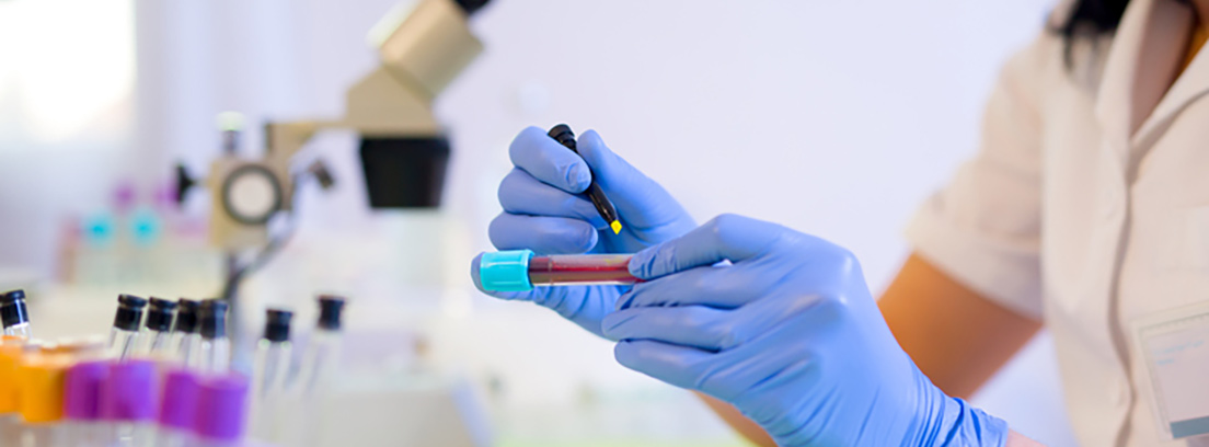 analista en un laboratorio con un tubo de sangre