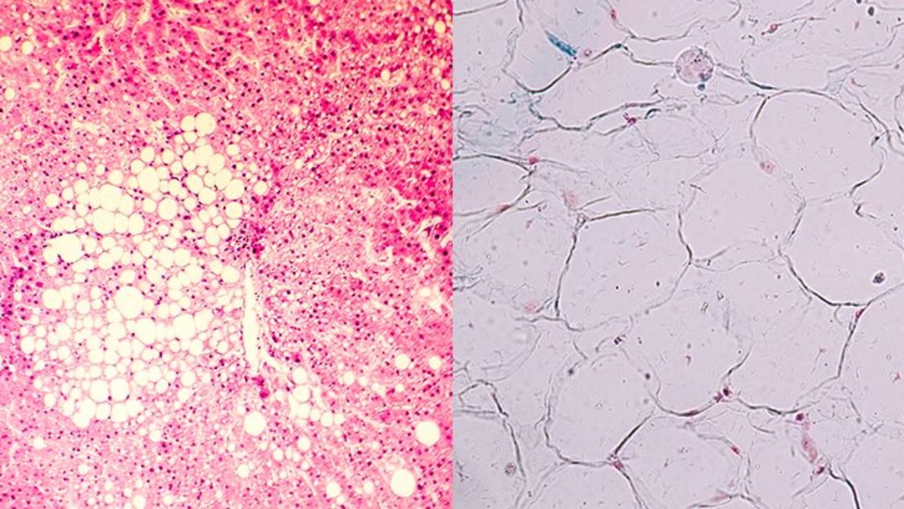 total de grasa en el cuerpo humano