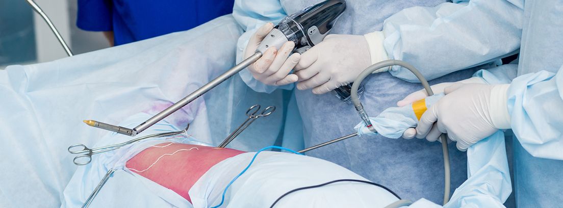 cirujanos realizando una biopsia muscular