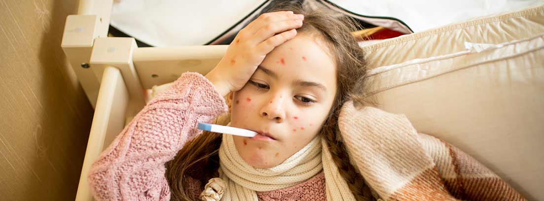 niña con sarampión tomándose la temperatura