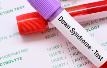tubos de ensayo para realizar test de síndrome de down