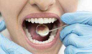 Dentista examinando la boca de una paciente