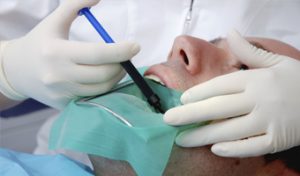 Dentista haciendo una endodoncia
