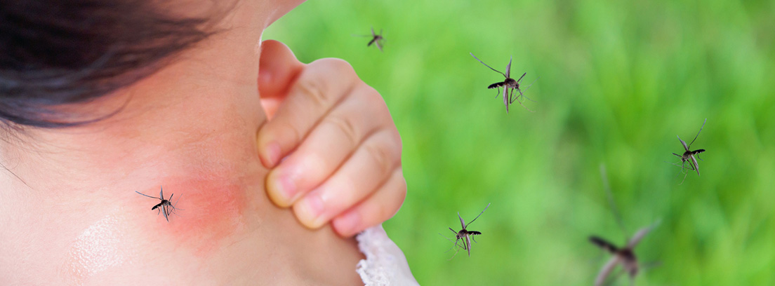 Síntomas del dengue y contagio por mosquitos –canalSALUD
