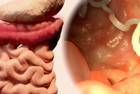 aparato digestivo e imagen de tenia en intestino