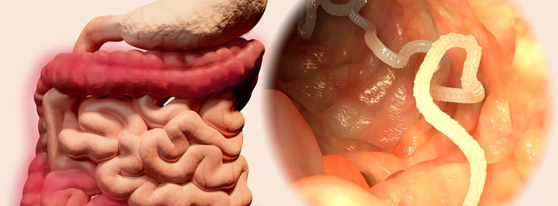 aparato digestivo e imagen de tenia en intestino
