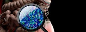 SIBO: bacterias en el intestino delgado
