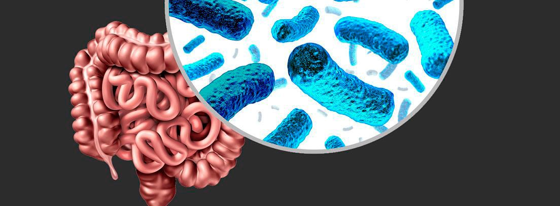 SIBO: intestino y lupa observando las bacterias