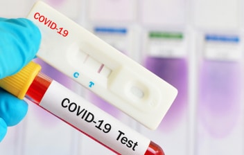 DIFERENCIAS: PCR, TEST RÁPIDO Y TEST SEROLÓGICOS DE ANTICUERPOS DEL COVID-19: TEST RÁPIDO