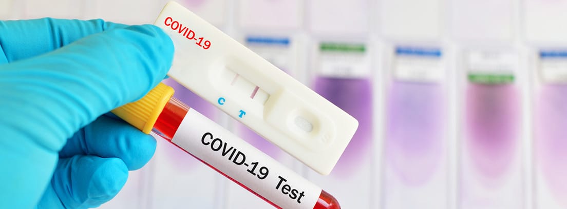 DIFERENCIAS: PCR, TEST RÁPIDO Y TEST SEROLÓGICOS DE ANTICUERPOS DEL COVID-19: TEST RÁPIDO