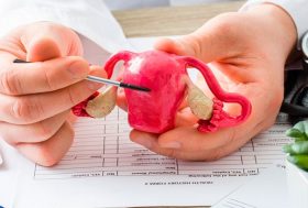 ¿Qué es el útero en anteversión? médico con una maqueta de un útero señalando la patología