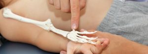 ¿Qué es la Acondroplasia?: médico midiendo la longitud del hueso del niño