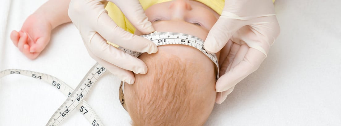 Macrocefalia: medición del perímetro cefálico de un bebé