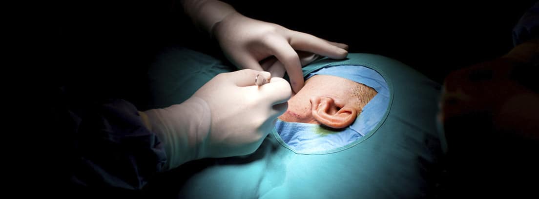 Colesteatoma: operación de quiste en el oído