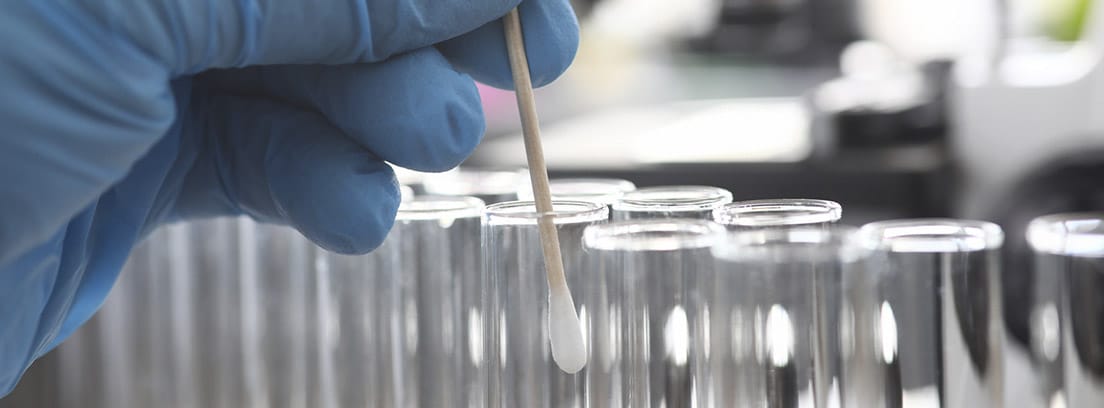 Test de la amilasa: laboratorio con tubos de ensayo