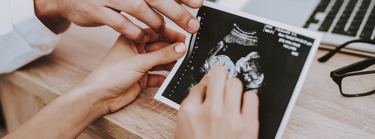 Consulta médica en el primer trimestre de embarazo: manos de hombre y de mujer cogiendo una ecografía de un bebé