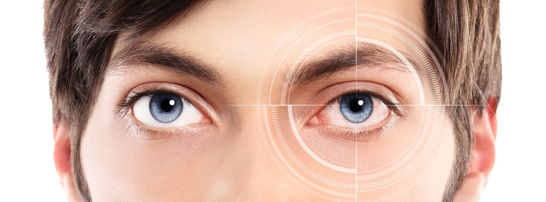 ¿Qué es la fotoqueratis y por qué se produce? jóven de ojos azules con lesión en uno de ellos