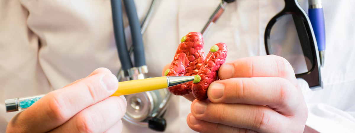 Cáncer de tiroides: doctor con un módelo de glándula del tiroides en la mano 