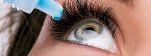 Pterigión en el ojo: ojo de mujer echándose un colirio