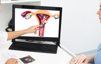 Quiste en la glándula de bartholino y bartholinitis: mujer en consulta de ginecología viendo un quiste en una imagen