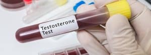 ¿Qué es la testosterona y por qué baja? Tubo de ensayo con muestra de sangre, test de testosterona