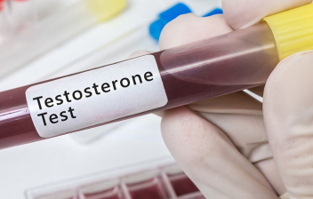 ¿Qué es la testosterona y por qué baja? Tubo de ensayo con muestra de sangre, test de testosterona