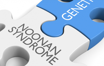 Síndrome de Noonan: piezas de puzzle blanca y azul escritas