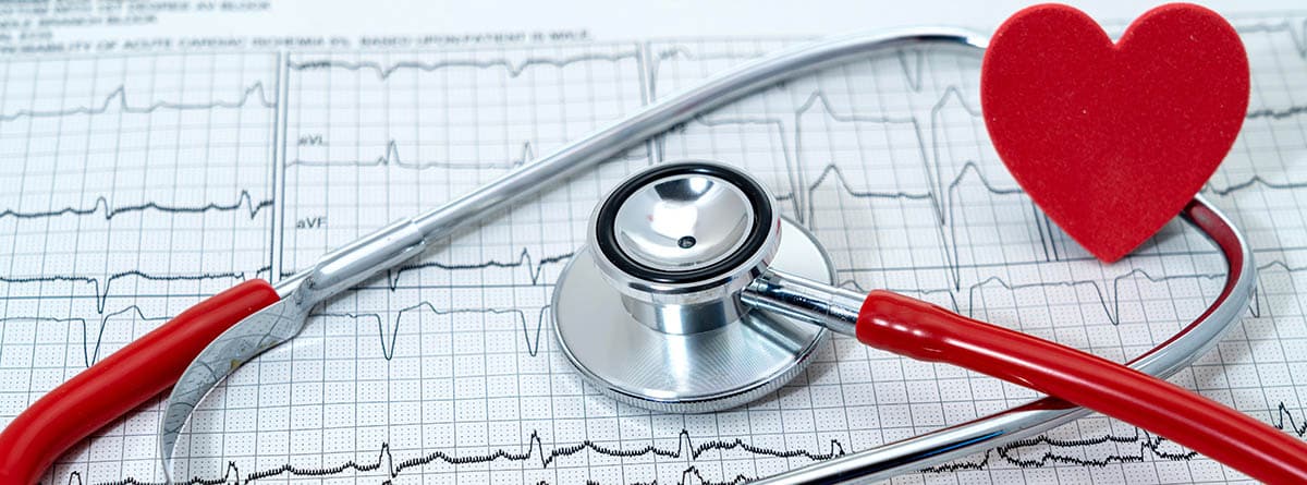 Diagn´stico precoz de enfermedades coronarias: Trazo cardíaco de un electrocardiograma, un estetoscopio médico y un corazón