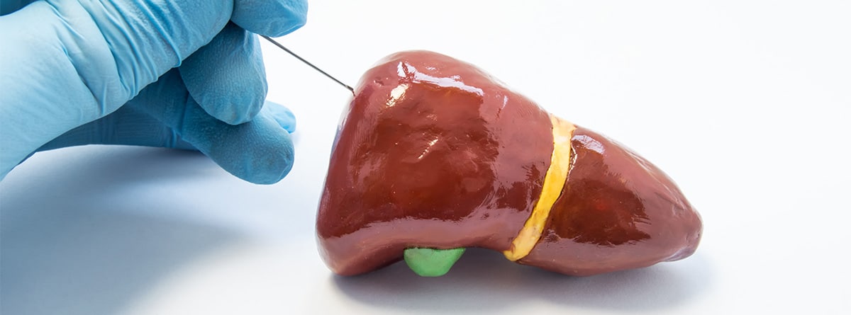 Fotografía de un hígado siendo examinado