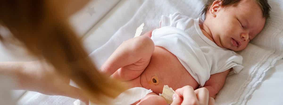 Cuidados del ombligo: recién nacido tumbado en la cama y doctora curando el ombligo