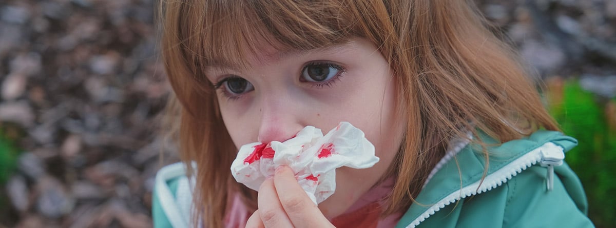 Niña tratando de detener el sangrado de la nariz usando un pañuelo de papel