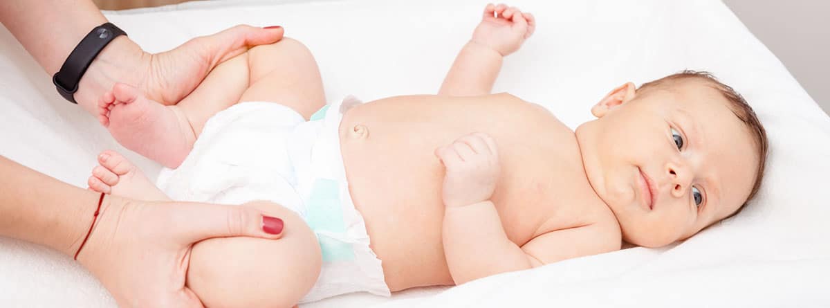 Luxación congénita de cadera en bebés: bebé tumbado con las piernas abiertas con problemas de cadera