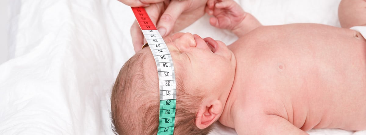 Microcefalia: bebé tumbado y especialista midiendo la cabeza