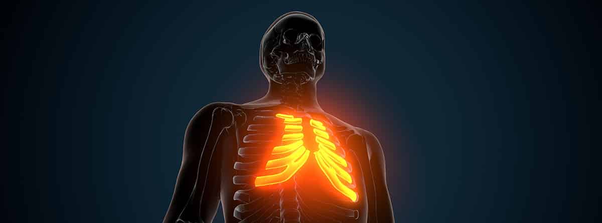 ¿Qué es la costocondritis?: cartílago del esternón