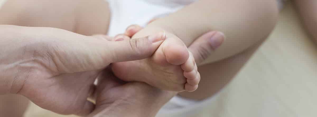 Pie equinovaro o zambo: bebé con un problema en el pie