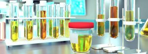 Análisis de sedimento de orina: tubos de ensayo con muestra de orina en laboratorio